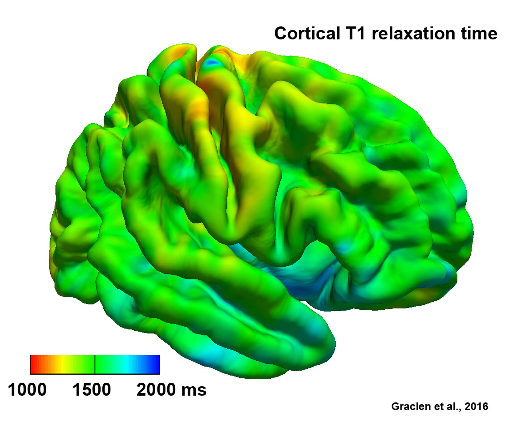 Cortical T1 Map - Quantitative MRI